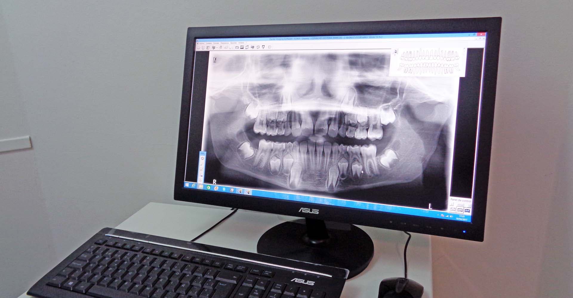 Especialista en implantes dentales en Ponteareas